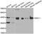 G Protein Subunit Alpha 11 antibody, STJ23811, St John