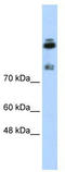 High Density Lipoprotein Binding Protein antibody, TA345915, Origene, Western Blot image 