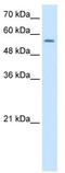 Nuclear Receptor Subfamily 1 Group H Member 2 antibody, TA338113, Origene, Western Blot image 