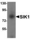 Salt Inducible Kinase 1 antibody, LS-B7102, Lifespan Biosciences, Western Blot image 