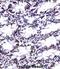 Cofilin 2 antibody, abx027809, Abbexa, Immunohistochemistry paraffin image 