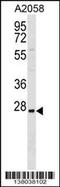 Tripartite Motif Containing 74 antibody, 59-532, ProSci, Western Blot image 
