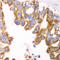 Glutamate Dehydrogenase 2 antibody, LS-C334823, Lifespan Biosciences, Immunohistochemistry paraffin image 