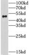 Cholinergic Receptor Nicotinic Alpha 3 Subunit antibody, FNab01676, FineTest, Western Blot image 