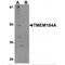 Transmembrane Protein 184A antibody, MBS151331, MyBioSource, Western Blot image 