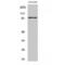 Serine/threonine-protein kinase tousled-like 2 antibody, LS-C386435, Lifespan Biosciences, Western Blot image 