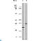 Eukaryotic Translation Initiation Factor 4E Binding Protein 1 antibody, LS-C812385, Lifespan Biosciences, Immunohistochemistry paraffin image 