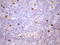 Myeloblastin antibody, LS-C791176, Lifespan Biosciences, Immunohistochemistry paraffin image 
