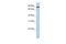 Transmembrane Protein 63A antibody, PA5-69093, Invitrogen Antibodies, Western Blot image 