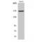 Collagen alpha-6(IV) chain antibody, LS-C382816, Lifespan Biosciences, Western Blot image 