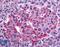 Somatostatin Receptor 1 antibody, LS-A997, Lifespan Biosciences, Immunohistochemistry paraffin image 