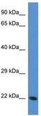 Transgelin 3 antibody, TA334926, Origene, Western Blot image 