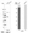 Natriuretic Peptide Receptor 3 antibody, NBP1-90163, Novus Biologicals, Western Blot image 