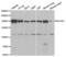 Rho Associated Coiled-Coil Containing Protein Kinase 2 antibody, abx004359, Abbexa, Western Blot image 