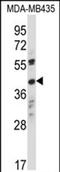 Olfactory Receptor Family 8 Subfamily K Member 1 antibody, PA5-71872, Invitrogen Antibodies, Western Blot image 