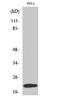 Ubiquitin Conjugating Enzyme E2 T antibody, A05874-1, Boster Biological Technology, Western Blot image 