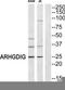 Rho GDP Dissociation Inhibitor Gamma antibody, TA313475, Origene, Western Blot image 