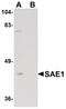SUMO1 Activating Enzyme Subunit 1 antibody, PA5-20957, Invitrogen Antibodies, Western Blot image 
