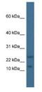 MAF BZIP Transcription Factor K antibody, NBP1-79223, Novus Biologicals, Western Blot image 