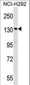 Signal-Induced Proliferation-Associated 1 antibody, LS-C161099, Lifespan Biosciences, Western Blot image 