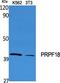 Pre-MRNA Processing Factor 18 antibody, A13674, Boster Biological Technology, Western Blot image 