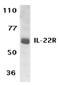 Interleukin 22 Receptor Subunit Alpha 1 antibody, LS-C406, Lifespan Biosciences, Western Blot image 