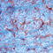Intercellular Adhesion Molecule 1 antibody, AF583, R&D Systems, Immunohistochemistry frozen image 