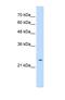 PTPN2 antibody, NBP1-60066, Novus Biologicals, Western Blot image 