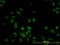Protein S100-A6 antibody, LS-B5528, Lifespan Biosciences, Immunofluorescence image 