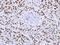 Heterogeneous Nuclear Ribonucleoprotein F antibody, LS-C186360, Lifespan Biosciences, Immunohistochemistry paraffin image 