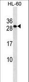 Transmembrane P24 Trafficking Protein 6 antibody, LS-C161956, Lifespan Biosciences, Western Blot image 