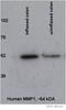 Matrix Metallopeptidase 1 antibody, ab52631, Abcam, Western Blot image 