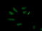 AP2M1 antibody, LS-C337387, Lifespan Biosciences, Immunofluorescence image 