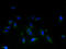 STEAP3 Metalloreductase antibody, A61182-100, Epigentek, Immunofluorescence image 