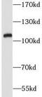 Vacuolar protein sorting-associated protein 18 homolog antibody, FNab09429, FineTest, Western Blot image 