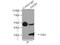 Hydroxyacyl-CoA Dehydrogenase antibody, 19828-1-AP, Proteintech Group, Immunoprecipitation image 