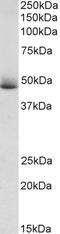 Scavenger Receptor Class B Member 1 antibody, 43-585, ProSci, Western Blot image 