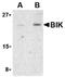 BCL2 Interacting Killer antibody, AP05587PU-N, Origene, Western Blot image 