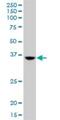 tRNA-splicing endonuclease subunit Sen34 antibody, H00079042-B01P, Novus Biologicals, Western Blot image 