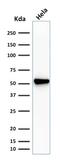 Fascin Actin-Bundling Protein 1 antibody, GTX34719, GeneTex, Western Blot image 