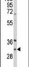 Inhibitor Of Growth Family Member 5 antibody, PA5-26494, Invitrogen Antibodies, Western Blot image 