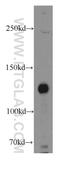 Tensin 3 antibody, 20053-1-AP, Proteintech Group, Western Blot image 