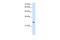 Phosphopantothenoylcysteine Decarboxylase antibody, A12120, Boster Biological Technology, Western Blot image 