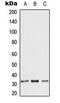 ADP/ATP translocase 3 antibody, LS-C353890, Lifespan Biosciences, Western Blot image 