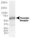 Coagulation Factor II Thrombin Receptor antibody, TA309650, Origene, Western Blot image 