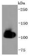 Heat Shock Protein Family A (Hsp70) Member 4 antibody, A03618-1, Boster Biological Technology, Western Blot image 