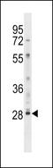 Lymphocyte Antigen 6 Family Member G6F antibody, LS-C163932, Lifespan Biosciences, Western Blot image 