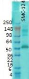 Calcium/Calmodulin Dependent Protein Kinase II Alpha antibody, NB100-1983, Novus Biologicals, Western Blot image 