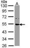 Small RNA Binding Exonuclease Protection Factor La antibody, PA5-29763, Invitrogen Antibodies, Western Blot image 