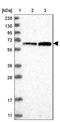 Tetratricopeptide Repeat Domain 24 antibody, NBP1-90920, Novus Biologicals, Western Blot image 